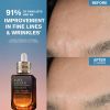 Advanced Night Repair Serum Synchronized Multi-Recovery Complex Recenzii