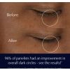 Cremă de ochi Advanced Night Repair Eye Supercharged Gel-Creme în borcan ediție limitată