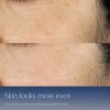 Advanced Night Repair Serum Duo Synchronized Multi-Recovery Complex Recenzii